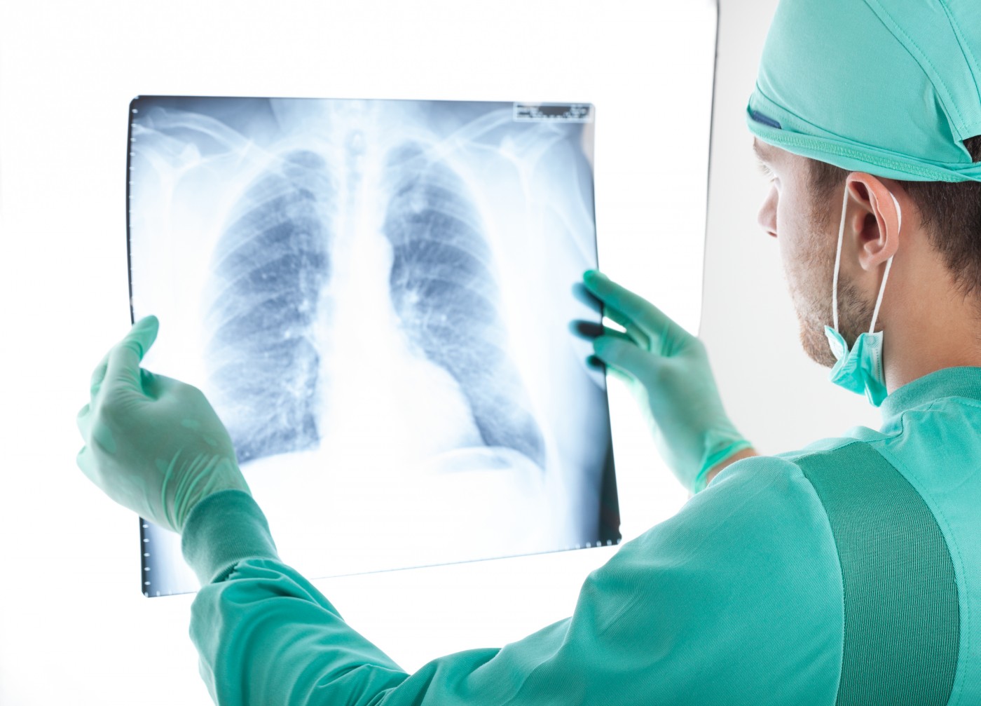 Surgical Choice for NSCLC Patients Depends on Surgeon Surgical Choice for NSCLC Patients Depends on Surgeon