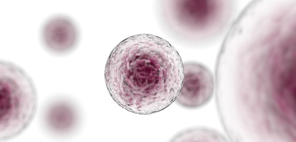 Immunotherapy Combo Shows Promise in Chemotherapy-naive NSCLC Immunotherapy Combo Shows Promise in Chemotherapy-naive NSCLC